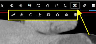 ../_images/annotate-image.png
